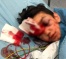 Wounded Jerusalem Child In Critical Condition After Suffering Hemorrhaging in The Brain