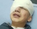 Video: "The kid lost his eye."