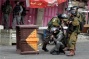 2 Palestinians critically wounded by live fire