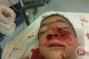 Palestinian boy, 10, critically injured by rubber bullet in Jerusalem