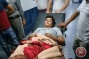 Israeli settlers assault, injure Palestinian teen in Nablus
